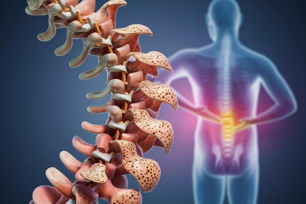 Patient experiencing neck stiffness and back pain due to spondylosis – spine care and pain management at IBAP Clinics Hyderabad